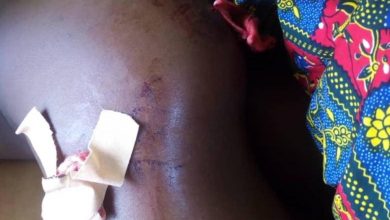 Injury of victim captured